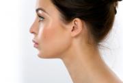 , Rhinoplasty (Nosejob) &#8211; UK Costs and abroad